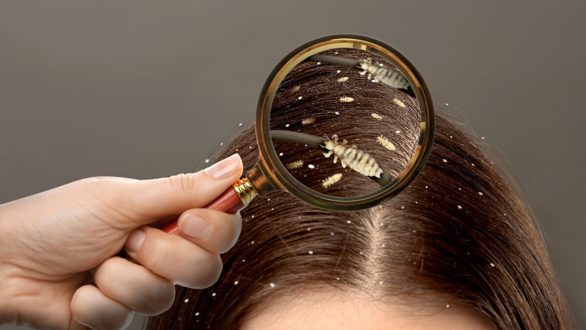 Wszawica u dzieci – o co najczęściej pytają rodzice?